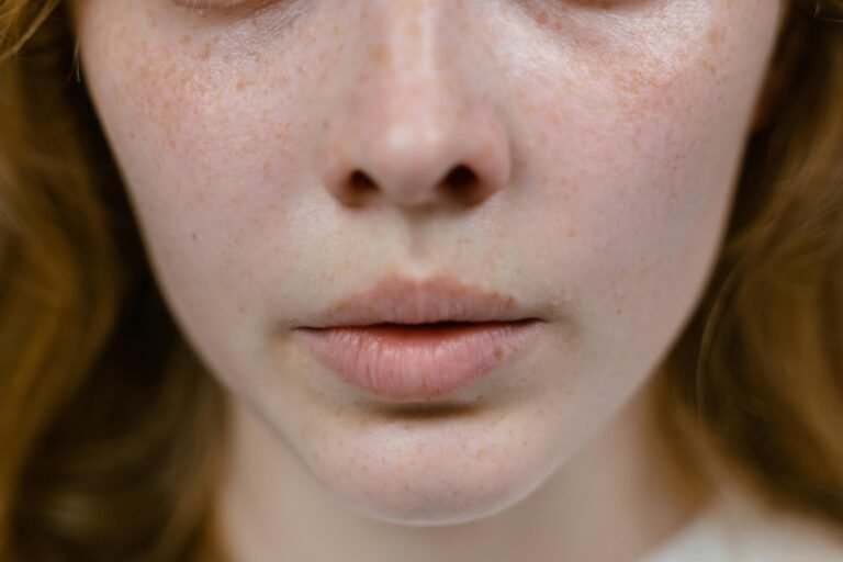 Close-up of a young woman with generally healthy skin, showing slight dryness on cheeks.